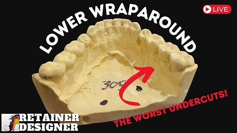 Lower Wraparound with the WORST undercuts!