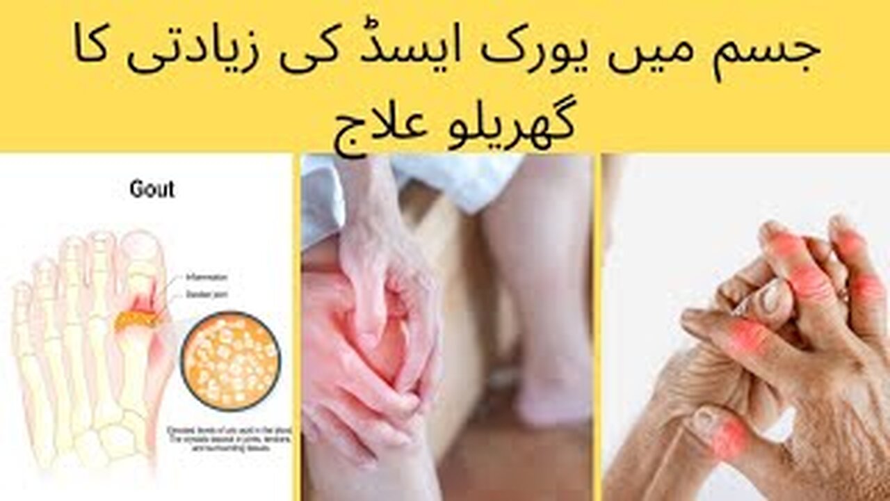 جسم میں یورک ایسڈ کی زیادتی کا آسان گھریلو علاج uricasid ka asaan illaj by api ji k ideas,uricacid