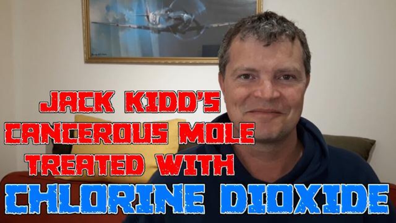 Jack Kidd Destroys a Cancerous Mole On His Pelvis Using Chlorine Dioxide (MMS)