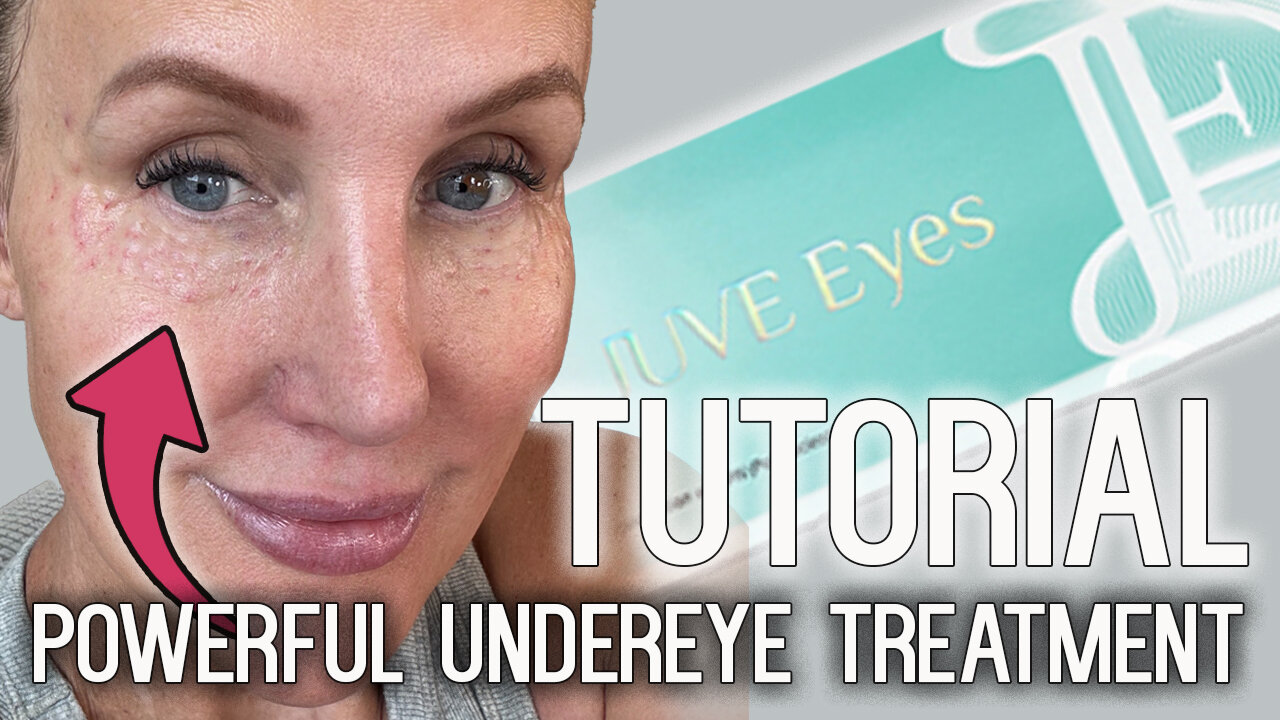 Juve Eyes Treatment Tutorial - Safety - Benefits