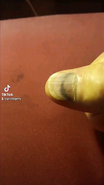 WAAAAA I AM HURT WAAAAA