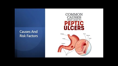 Peptic Ulcers - Causes & Risk Factors