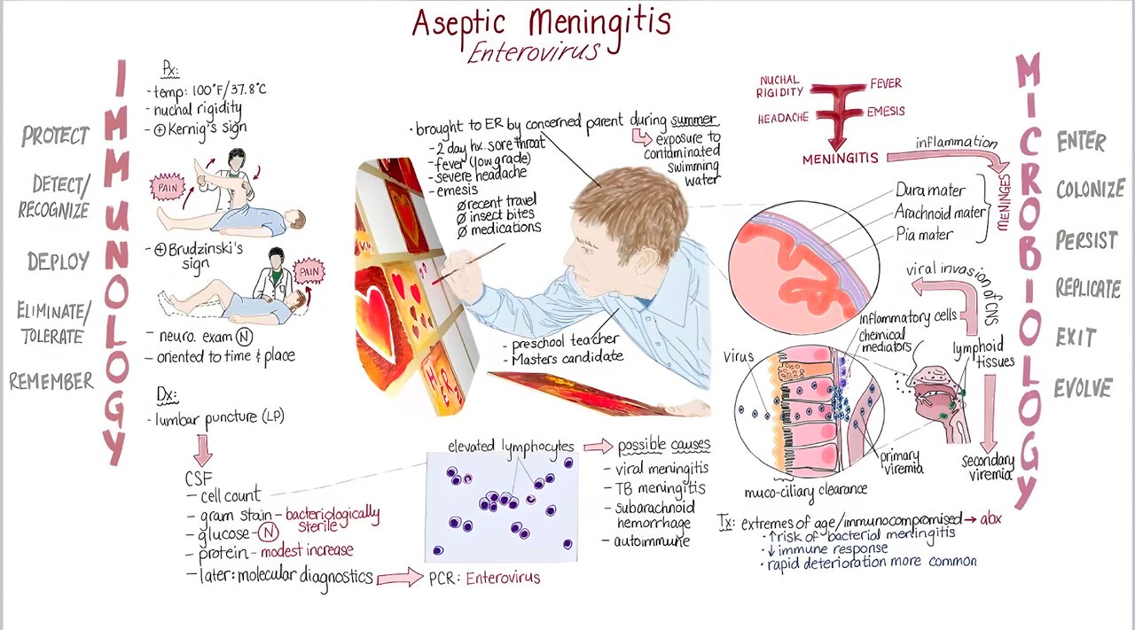 "Enterovirus" Aseptic Meningitis - Springboard - Maya Adam, MD