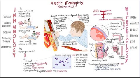 "Enterovirus" Aseptic Meningitis - Springboard - Maya Adam, MD