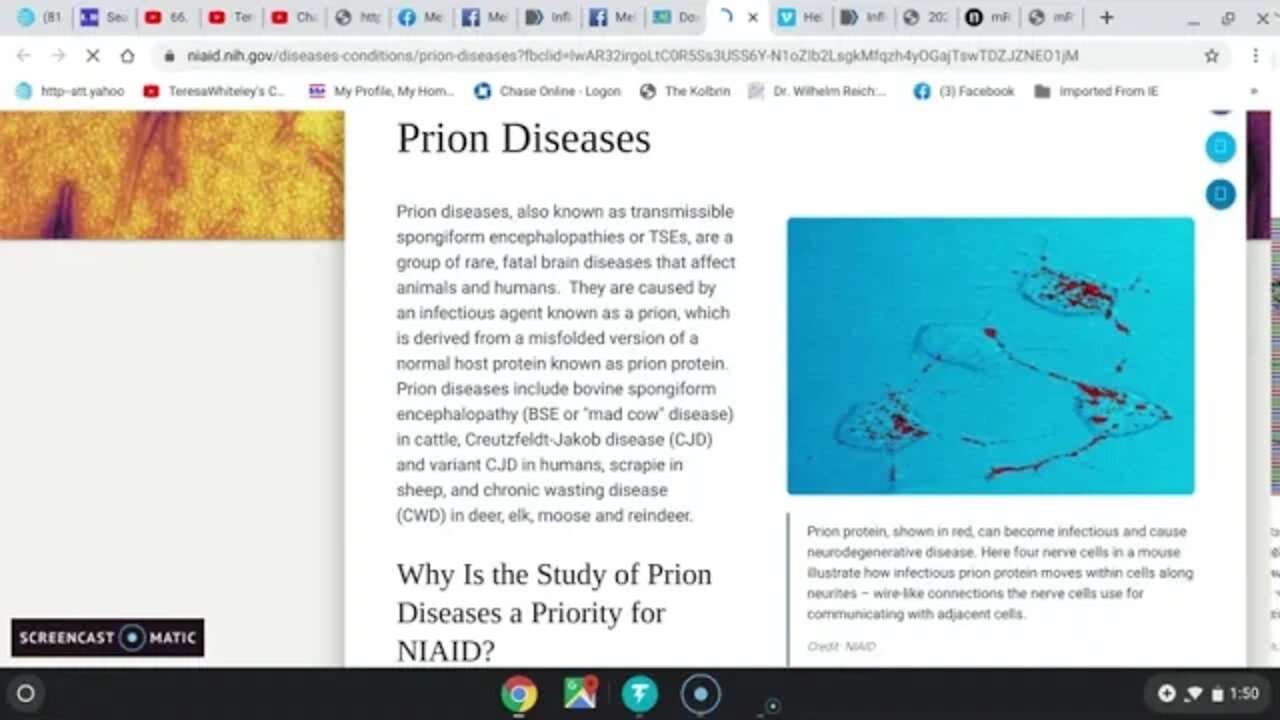 More on Epstein Borrielosis AIDS with Mel