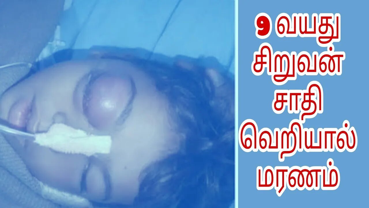 Rajasthan 9Years Old Boy Death #rajasthan #death #smallboy