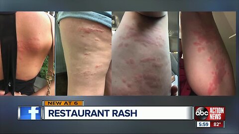 Downtown St. Pete bar 'voluntarily closing' amid complaints of rashes, inspectors find bed bug