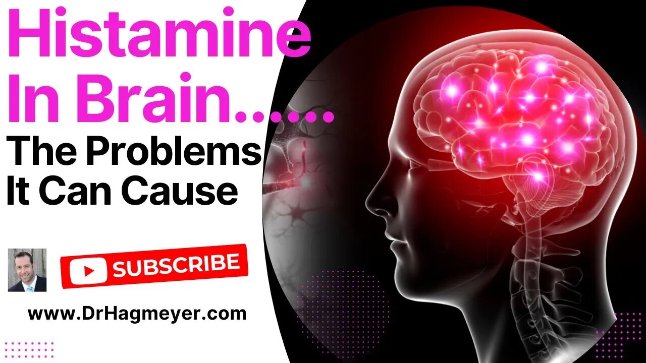 Is Excess Brain Histamine The Cause of Your Symptoms?