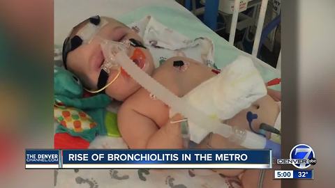 Rise of bronchiolitis in the Denver metro