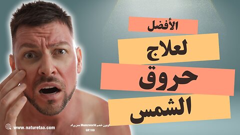 حروق الشمس | وصفات لعلاج حروق الشمس #العودة_للطبيعة