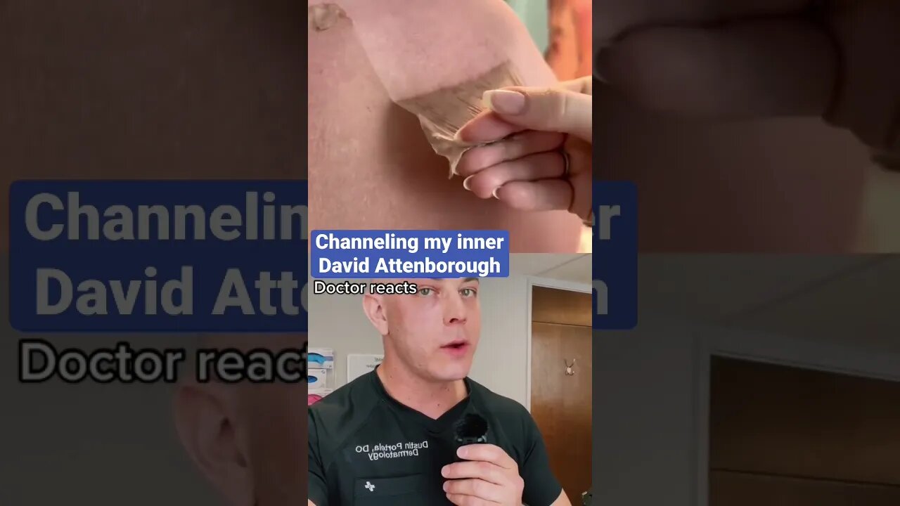 Doctor narrates insane sunburn!