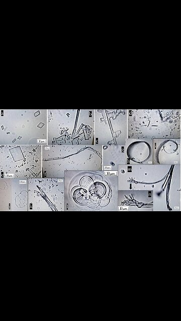 There is an effective and natural method to repel mosquitoes...