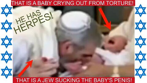 BREAKING: JEWISH RITUAL SEXUAL ABUSE! JEWISH MOHEL GIVES HERPES TO BABIES! MSM COVERAGE! - LOOK! 👀