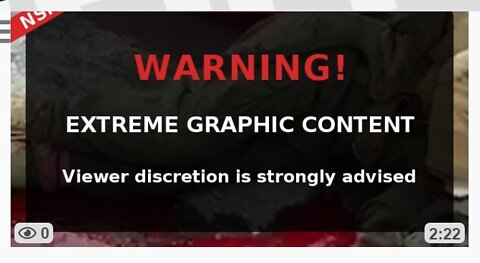 ⚠️WARNING❗️Graphic Content⚠️ 😱Cold hard evidence of Ukrainian Nazi war crimes exposed! Share!