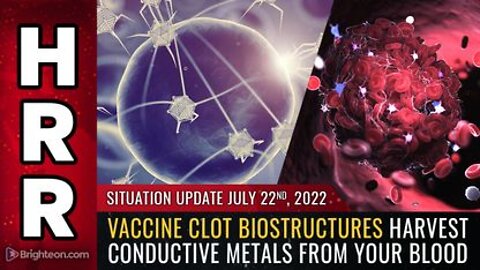 07-22-22 S.U. - Vaccine CLOT BIOSTRUCTURES Harvest Conductive Metals From Your BLOOD