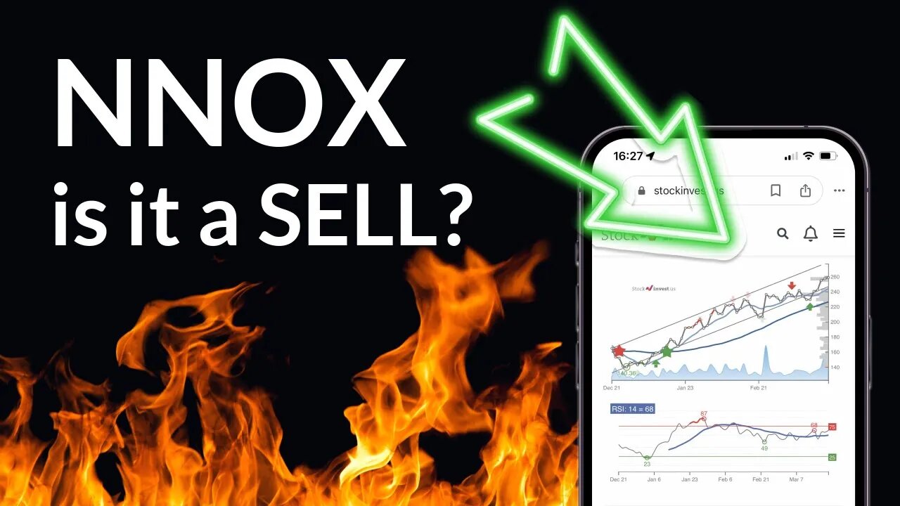 Nano-X Imaging Ltd.'s Market Moves: Comprehensive Stock Analysis & Price Forecast for Thu - Invest W