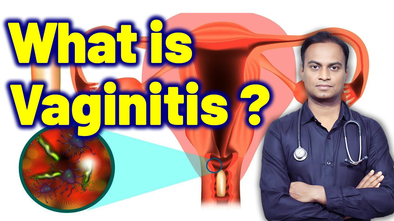 What is Vaginitis? Treatment Cure Medicine Surgery | Gynaecology Women Female | Dr. Bharadwaz