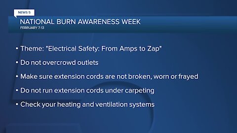 Today marks the start of National Burn Awareness Week