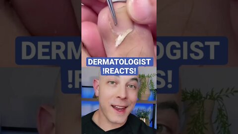 Derm reacts to massive ingrown toenail!!