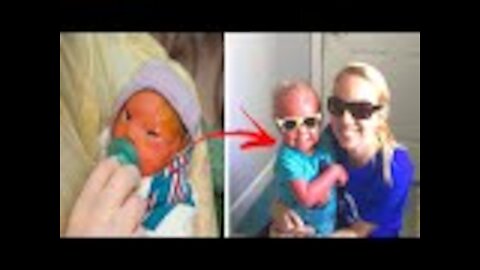 Mom is shocked when she sees her newborn in the delivery room her words are spreading like wildfire