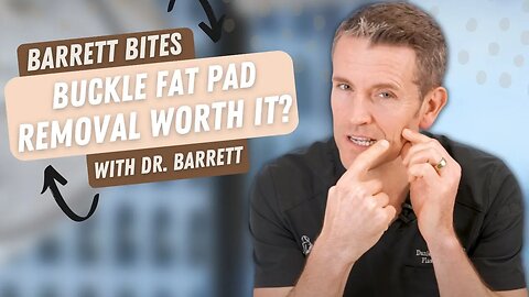 Should You Remove Your Buccal Fat Pads? | Barrett Plastic Surgery