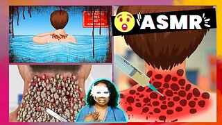 ASMR Removal Mggot Infected & Dog Ticks Severely Injured Animation