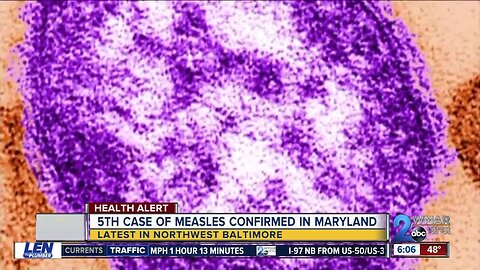 Fifth measles case reported in Maryland