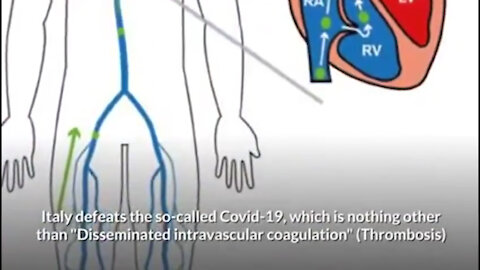 ITALIAN DOCTORS IGNORE WHO ORDER TO BURY OR CREMATE COVID-19 VICTIM BODIES WITH NO POST MORTEM.