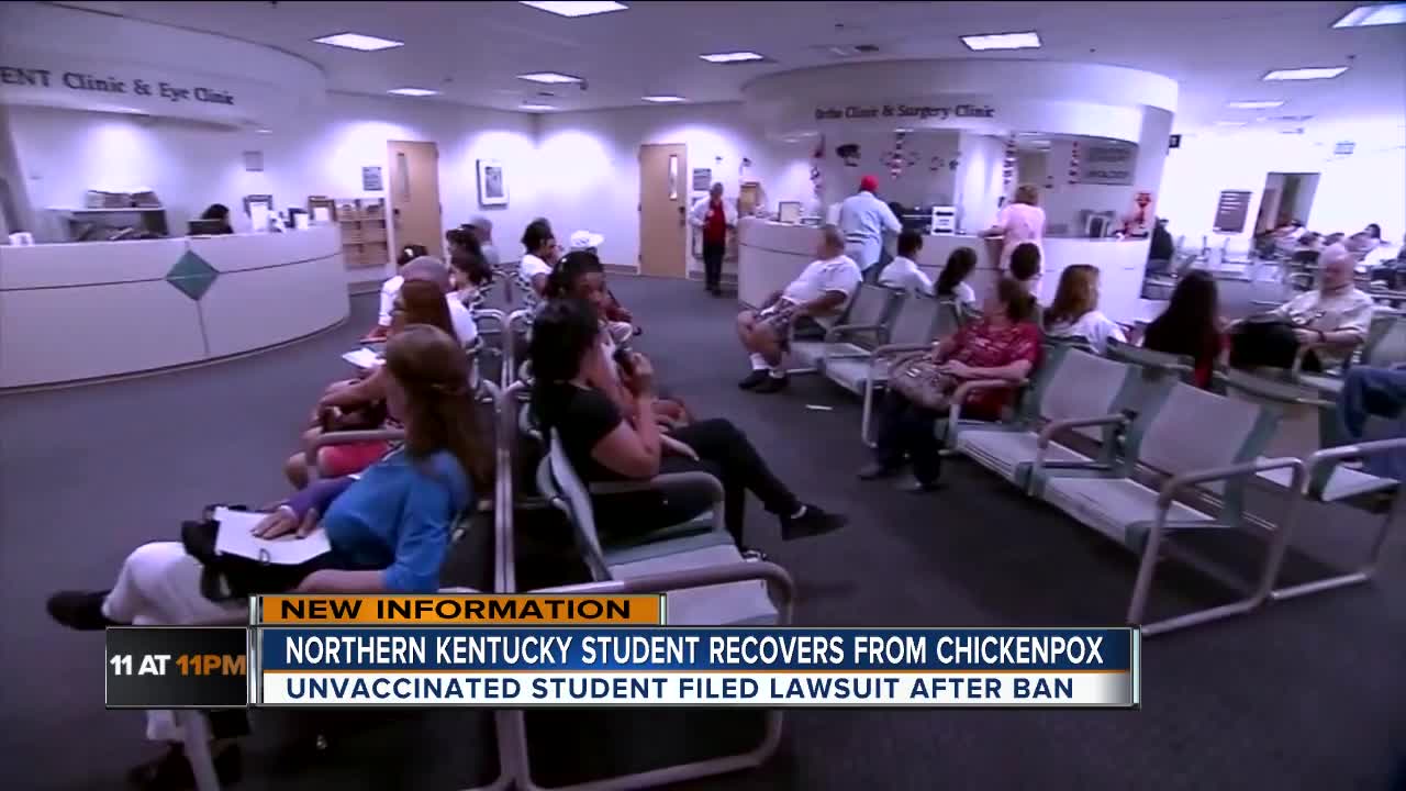 Unvaccinated student fighting chickepox ban caught it, is back in school