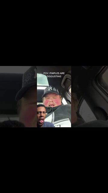 POV: PIMPLES ARE DISGUSTING #shorts