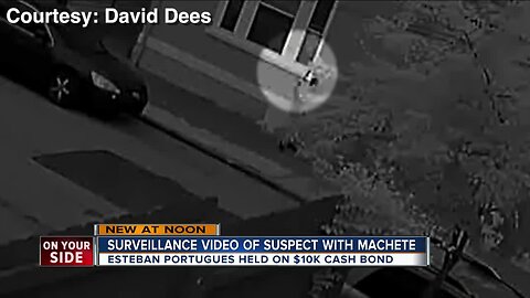 Boy hurt in alleged machete attack home recovering, mom says