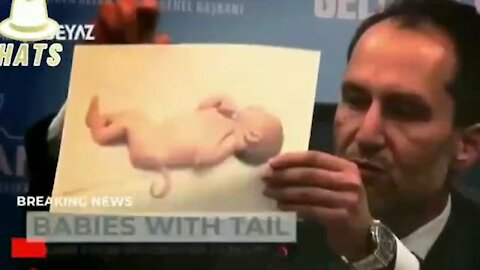 BABIES BORN WITH TAILS AND OTHER MAJOR DEFECTS!!!