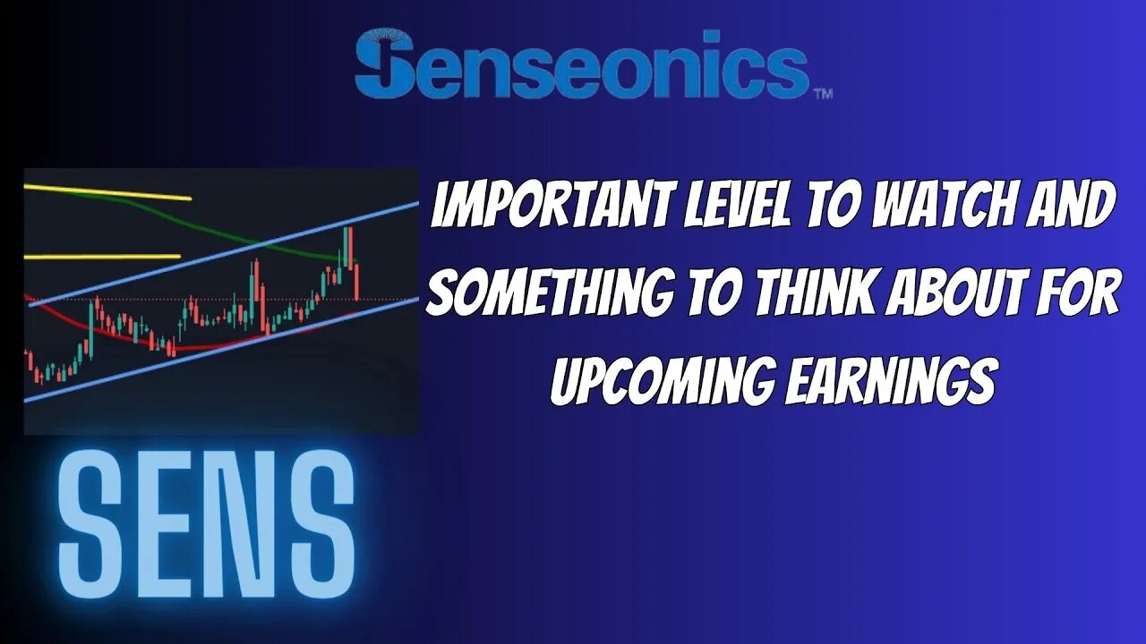 Sens Stock Important Pattern To Watch & Something Huge In Upcoming Earnings To Expect