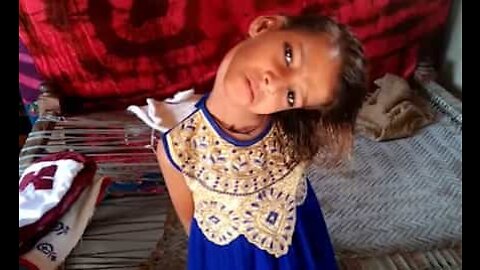 Le cou de cette enfant pakistanaise est tordu à 180 degrés