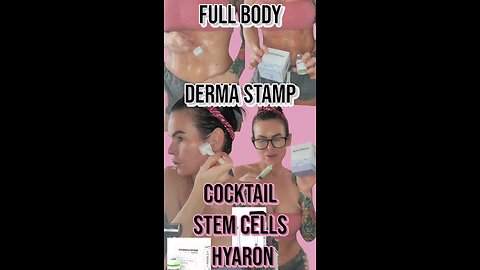 Full Body Derma Stamp with Stem Cell Hyaron