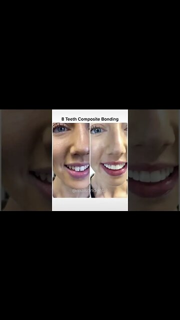 Dental And Teeth Hygiene