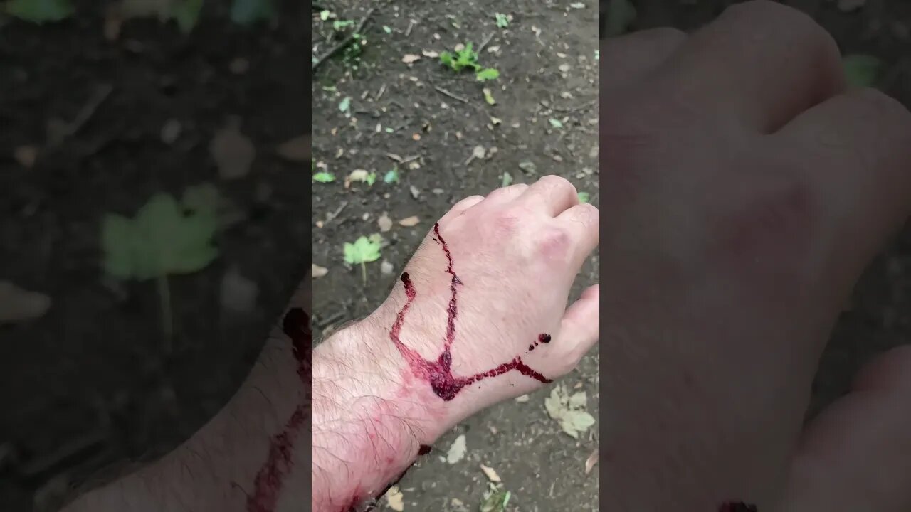 I had a little accident.