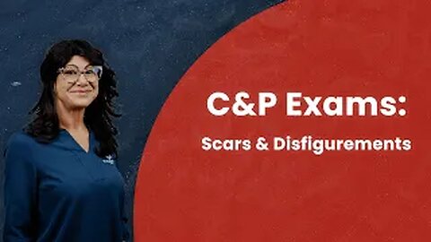 C&P Exams: Scars & Disfigurements