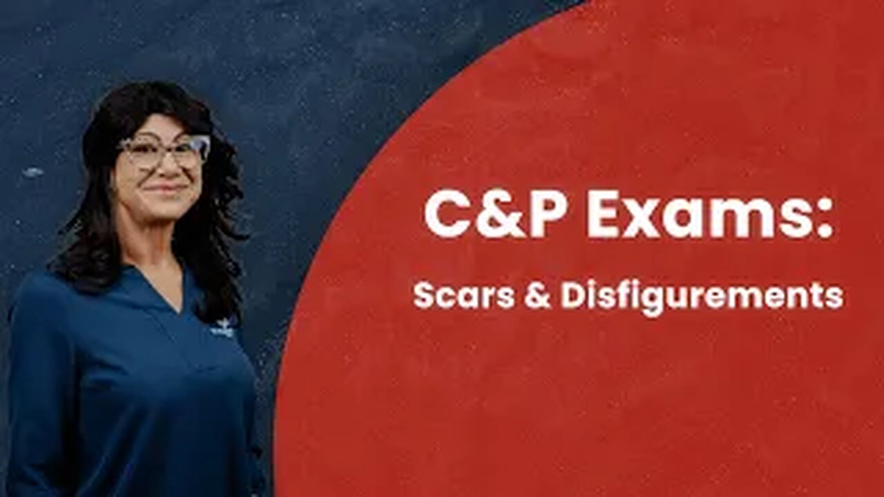 C&P Exams: Scars & Disfigurements
