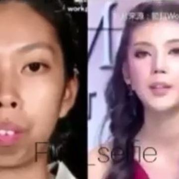 How Plastic Surgery Changed This Girl's Life