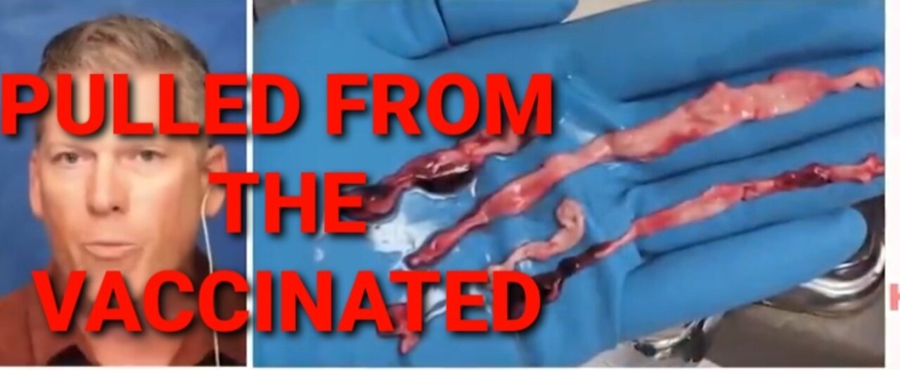 THE ANALYSIS OF THR WHITE EMBALMER CLOTS ARE IN THEY ARE SELF ASSEMBLING CIRCUITS
