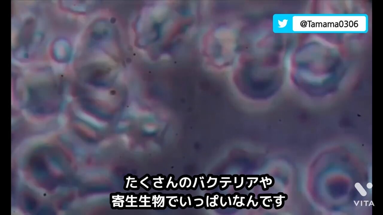 コロワク接種者と未接種者の血液比較