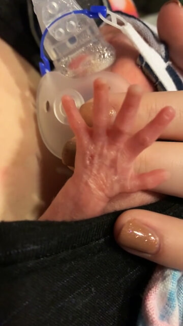 Little Preemie Stretches Out Hand