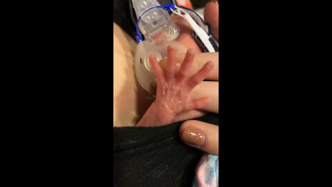 Little Preemie Stretches Out Hand