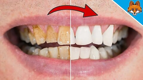 You will NOT believe how EASY you can WHITEN your Teeth 💥