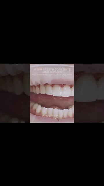 Dental And Teeth Hygiene