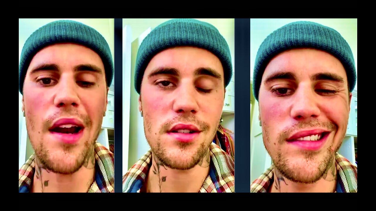 Jabbed Justin Bieber Cancels World Tour Dates Shocking Vaccine Side Effects Create Global Shockwaves