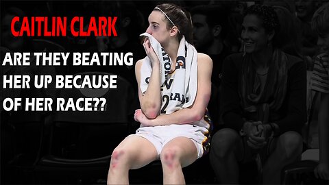 Are The WNBA Women Beating Caitlin Clark Up Because She Is White?