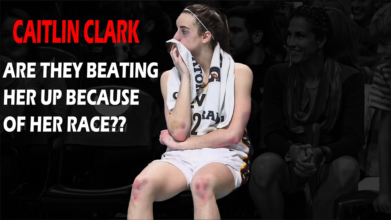 Are The WNBA Women Beating Caitlin Clark Up Because She Is White?