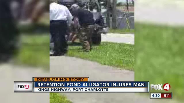 Retention Pond Alligator Injures Homeless Man